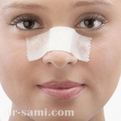 استراحت بعد از عمل بینی و نکات مهم مراقبتی برای بهبود سریع‌تر و کاهش تورم و درد