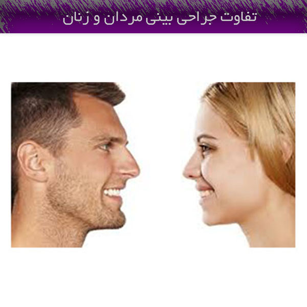 تفاوت جراحی بینی مردان و زنان