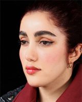 نمونه کار جراحی بینی به سبک نیمه فانتزی دکتر سامی - نمونه 3 بعد از عمل