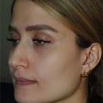 نمونه کار جراحی بینی به سبک نیمه فانتزی دکتر سامی - نمونه 1 قبل از عمل