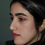 نمونه کار جراحی بینی به سبک نیمه فانتزی دکتر سامی - نمونه 3 قبل از عمل