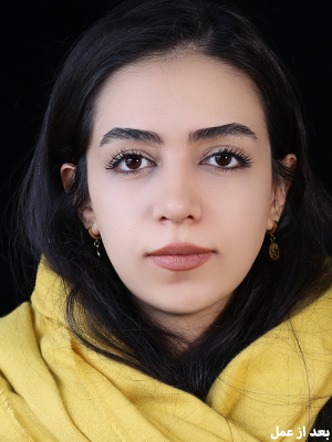 بینی با ساختار کج - دکتر سامی