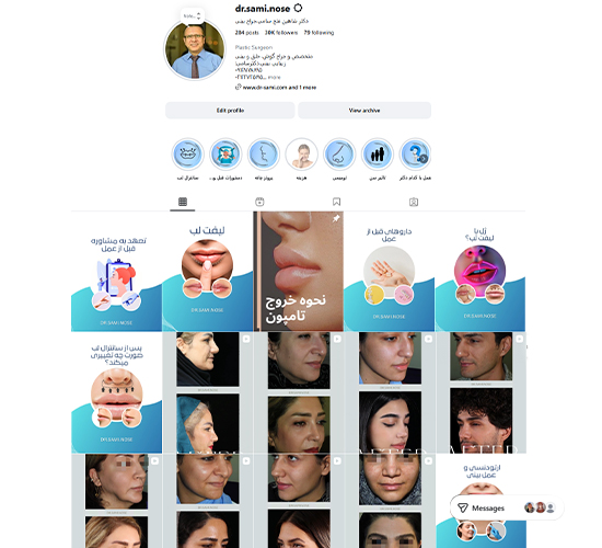 کانال اینستاگرام دکتر شاهین فتح سامی | بهترین جراح بینی طبیعی در تهران