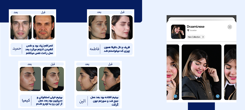 رضایت زیباجویان دکتر سامی